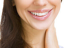 歯科矯正用アンカースクリューを使う治療